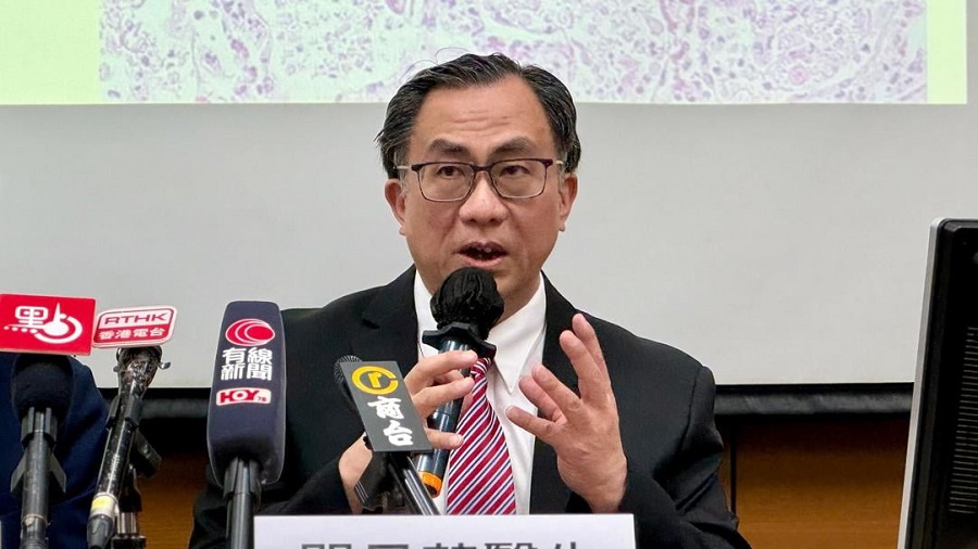 57歲男染侵入性腦膜炎雙球菌　關日華：料社區有無症狀感染者