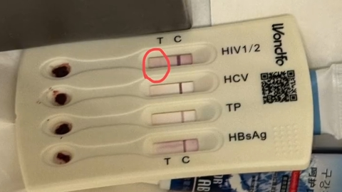 北京桔子水晶酒店洗漱包驚現帶血HIV檢測盒-住客緊急就醫憂感染