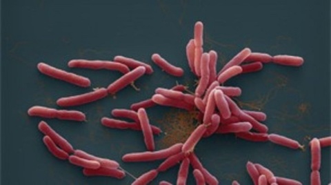 52歲長期病患男子染類鼻疽-居深水埗目前情況穩定