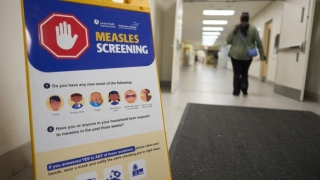 加拿大-消除麻疹國家-稱號被取消-連續12個月以上出現麻疹傳播