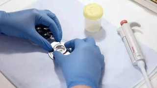 丹麥男精子攜帶致癌基因捐精助孕至少197孩-已知至少10人患癌