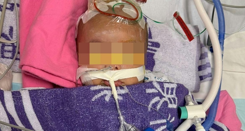 虐兒案-4個月大男嬰疑被虐待致腦出血失去知覺-警方拘兩名外傭