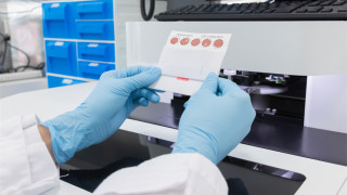 醫管局初生嬰免費篩查擴至私院-及早發現治療免疫缺陷病