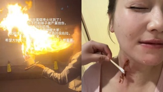 美人魚-女星王添羽玩-噴火蛋糕-致燒傷險毀容-發文控訴-被小紅書的視頻害慘了