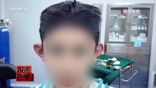 央視揭內地-精靈耳-整形亂象-術後恐致面癱或終身殘疾