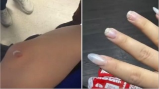 有片-23歲中國留學生澳洲街頭遭種族歧視毆打-事後診斷出腦震盪