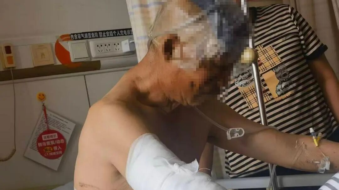 黑龍江六旬村民遭黑熊撕咬-頭皮破損臉皮外翻身上多處骨折