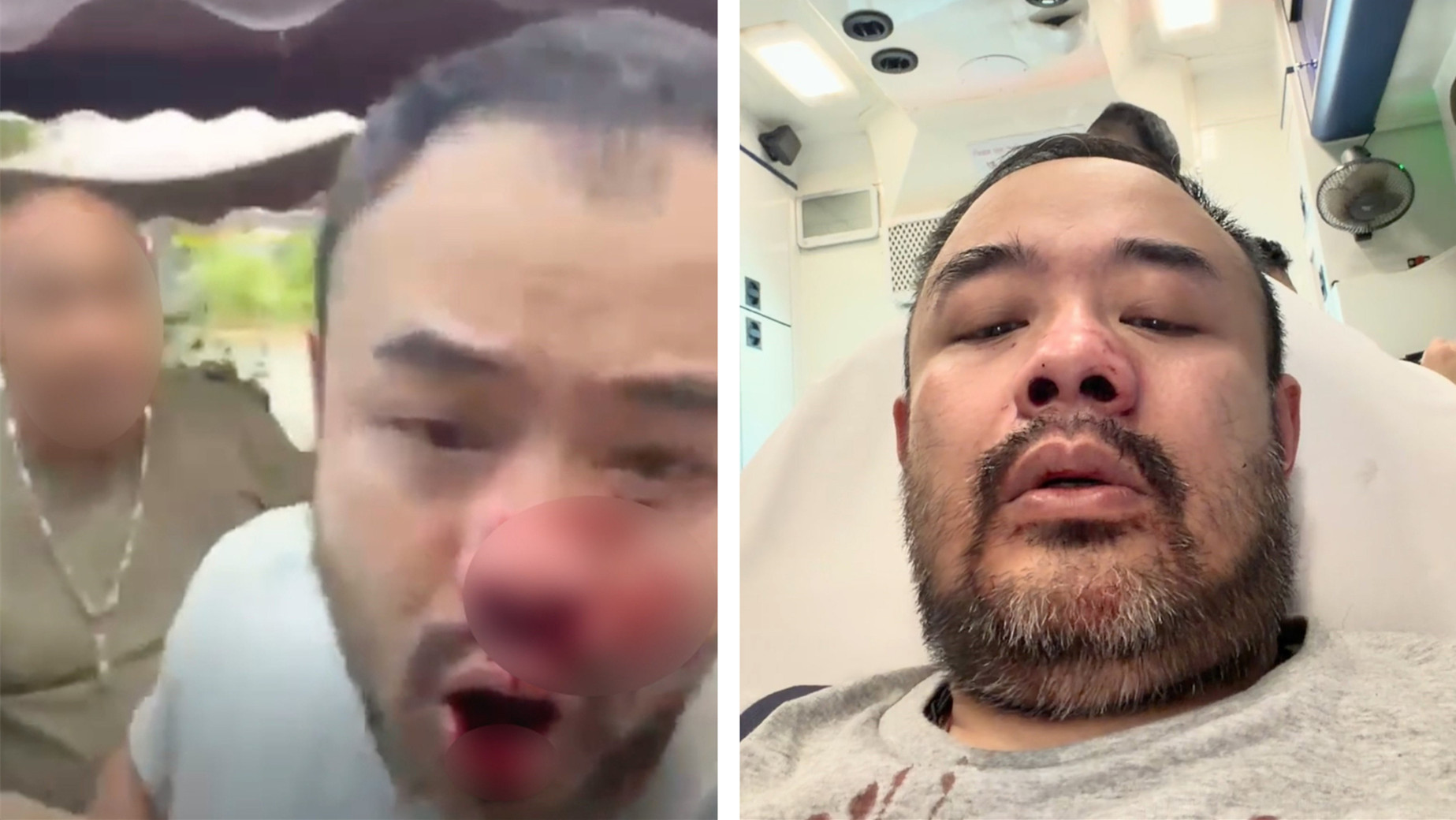 YouTuber邵子風新田直播遭拳毆浴血-涉施襲男子被捕