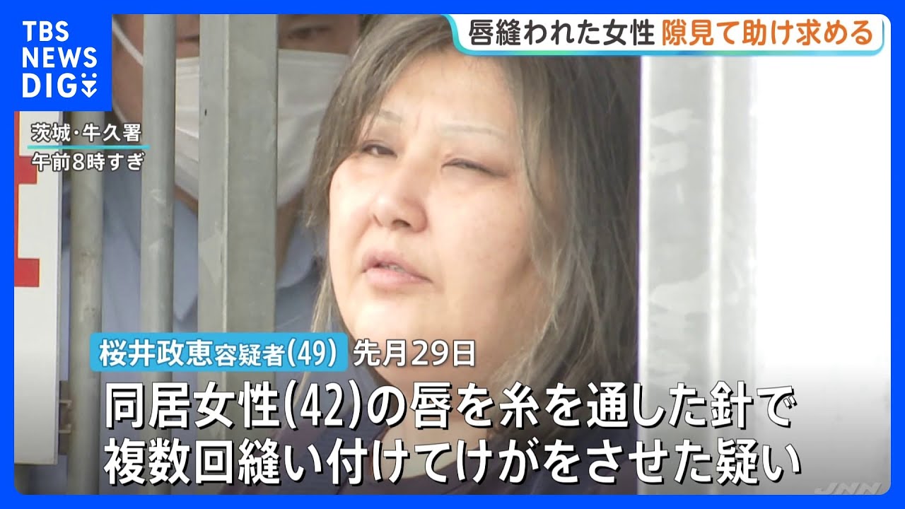 日本驚茨城縣女子遭同居女針線縫雙唇-逃亡商店寫字條求救