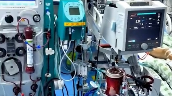 福建17歲少年不慎接觸農藥-敵敵畏--皮膚大片紅腫起泡被送入ICU
