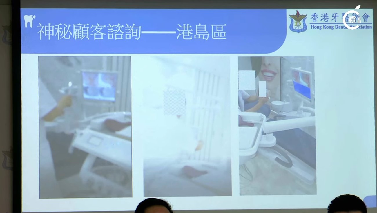 香港牙醫學會揭有境外牙科機構在港設諮詢處-內有職員進行非法行醫