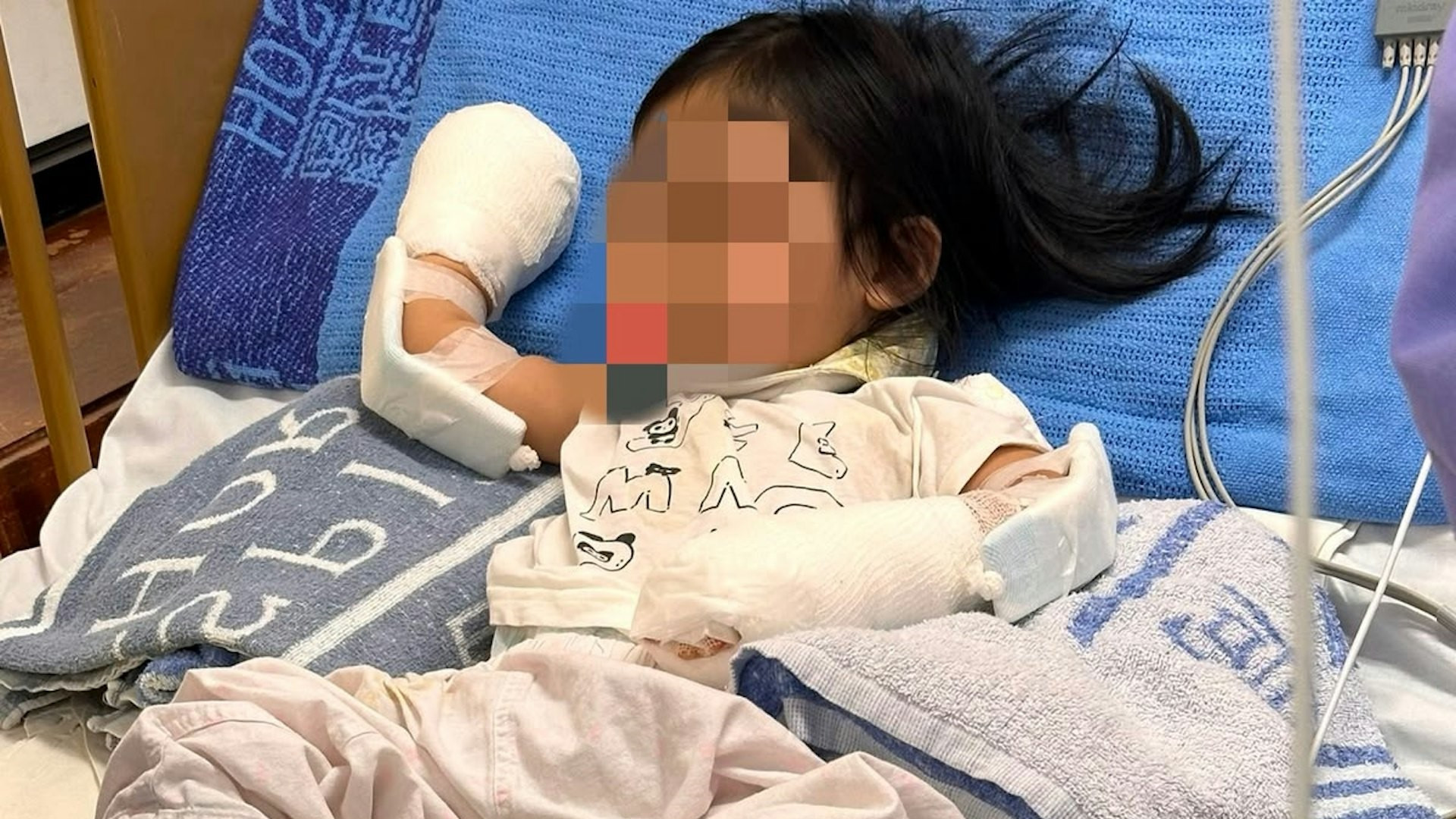 元朗兩歲女童被熱水燙傷手仍留醫-印傭被控虐兒明日提堂