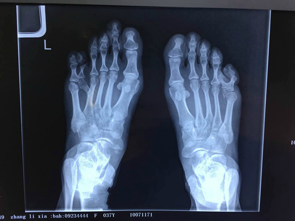 $!title_without_url!$