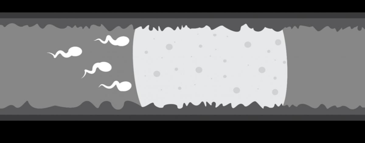 $!title_without_url!$