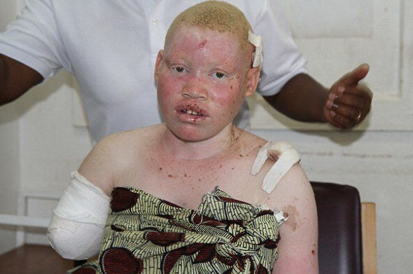 $!title_without_url!$