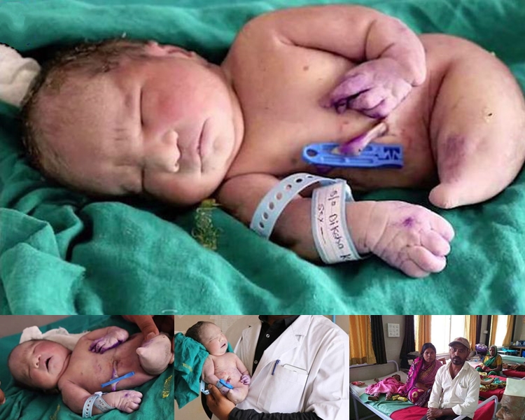 $!title_without_url!$