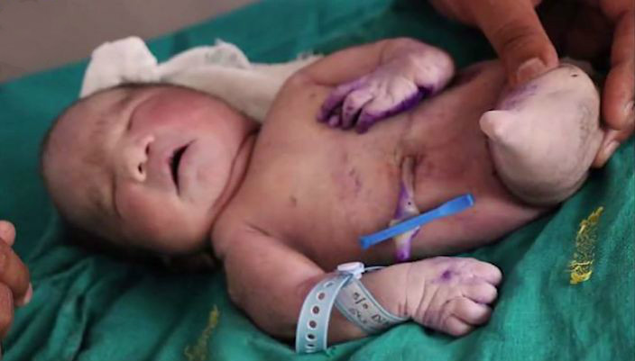 $!title_without_url!$