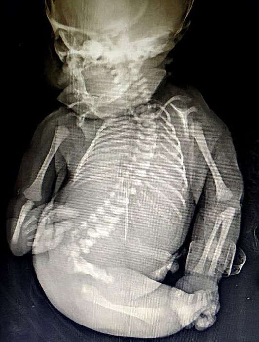 $!title_without_url!$