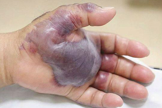 $!title_without_url!$