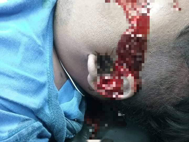 $!title_without_url!$