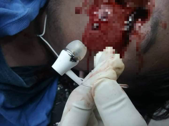 $!title_without_url!$