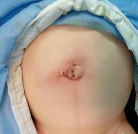 $!title_without_url!$