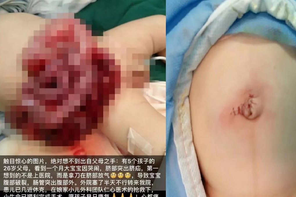 $!title_without_url!$