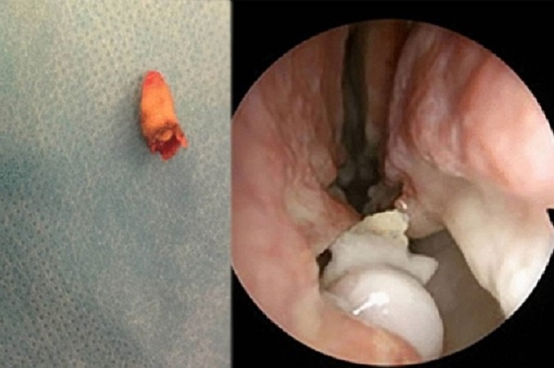 $!title_without_url!$