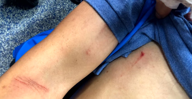 $!title_without_url!$