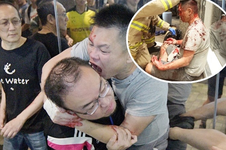 $!title_without_url!$