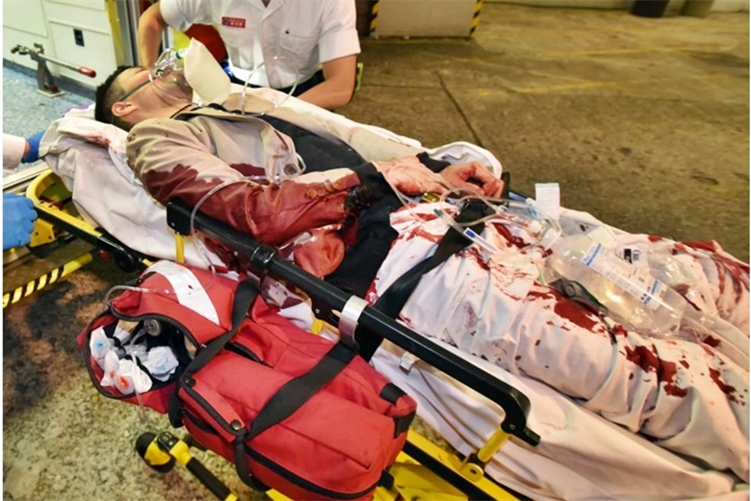 $!title_without_url!$