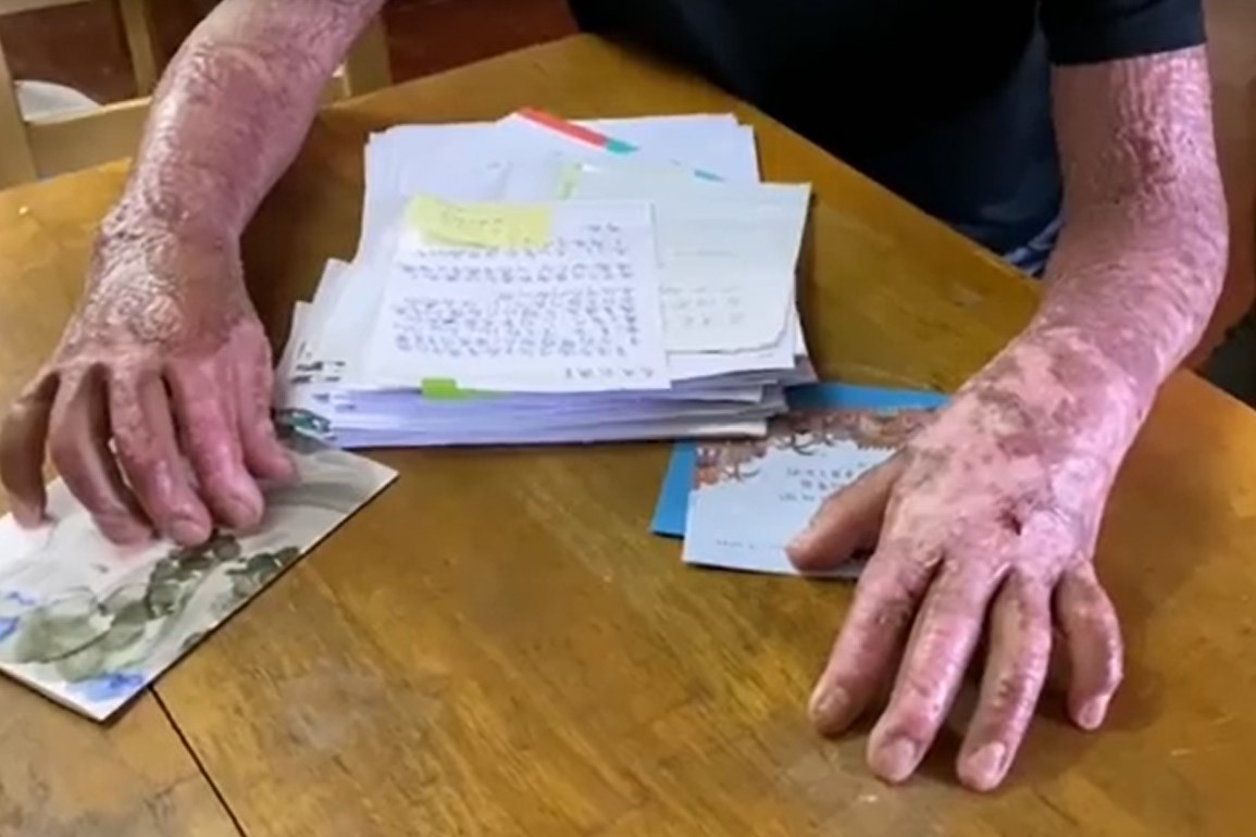 $!title_without_url!$